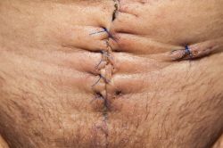 Nos prestations sur le secteur de Marseille 13000 en région PACA